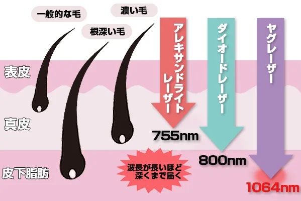 レーザーの波長の違いイメージ