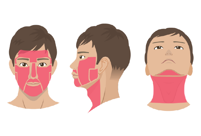 顔全体脱毛料金